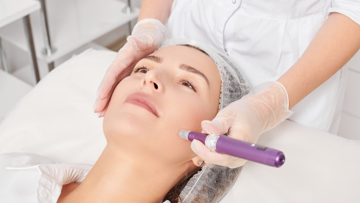 Hautpflege nach dem Microneedling