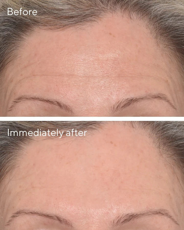 Murad RESURGENCE - TARGETED WRINKLE CORRECTOR