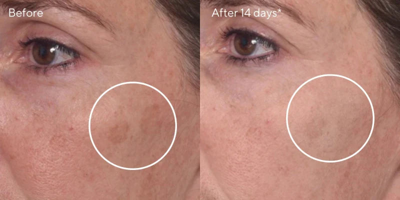 Murad E-SHIELD - RAPID DARK SPOT CORRECTING SERUM
