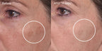 Murad E-SHIELD - RAPID DARK SPOT CORRECTING SERUM