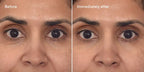 Murad RESURGENCE - RETINOL YOUTH RENEWAL EYE MASKS