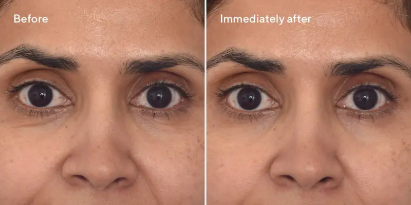 Murad RESURGENCE - RETINOL YOUTH RENEWAL EYE MASKS