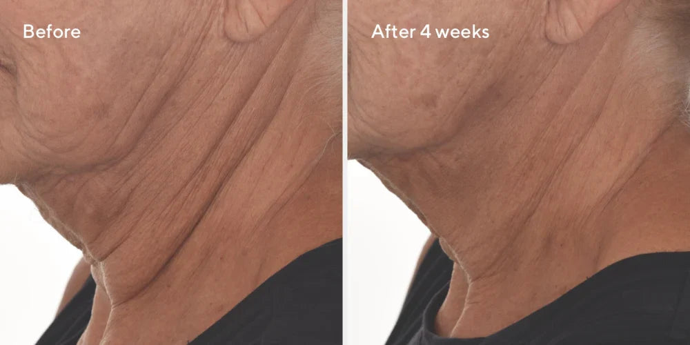 Murad RESURGENCE - RETINAL RESCULPT OVERNIGHT TREATMENT