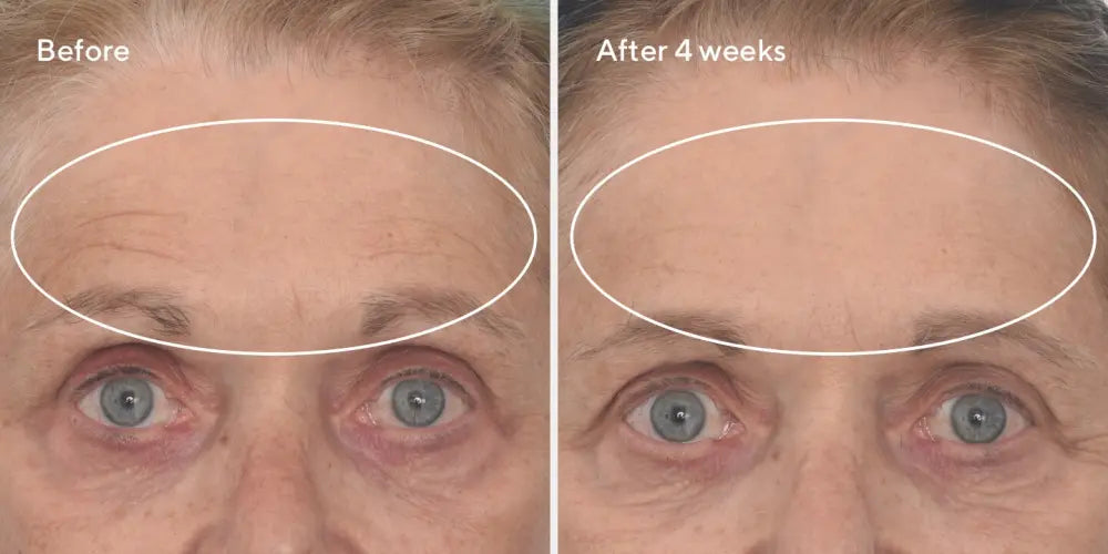 Murad RESURGENCE - RETINAL RESCULPT OVERNIGHT TREATMENT