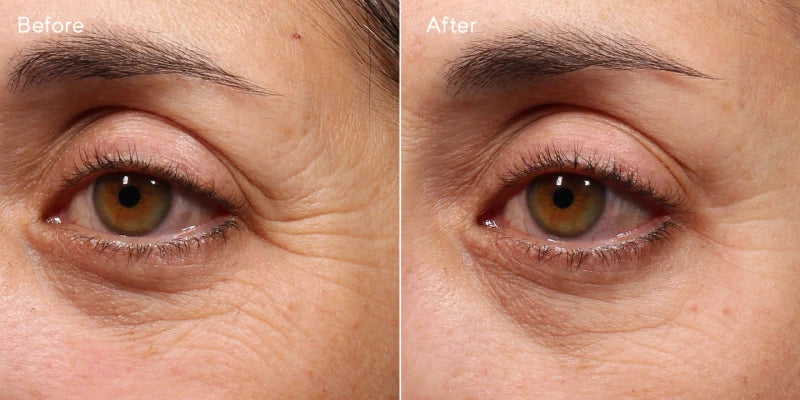 Murad RESURGENCE - RETINOL YOUTH RENEWAL EYE SERUM