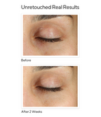 Murad E-SHIELD - VITA-C EYES DARK CIRCLE CORRECTOR