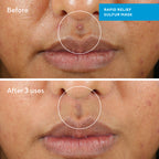 Murad BLEMISH CONTROL - RAPID RELIEF SULFUR MASK