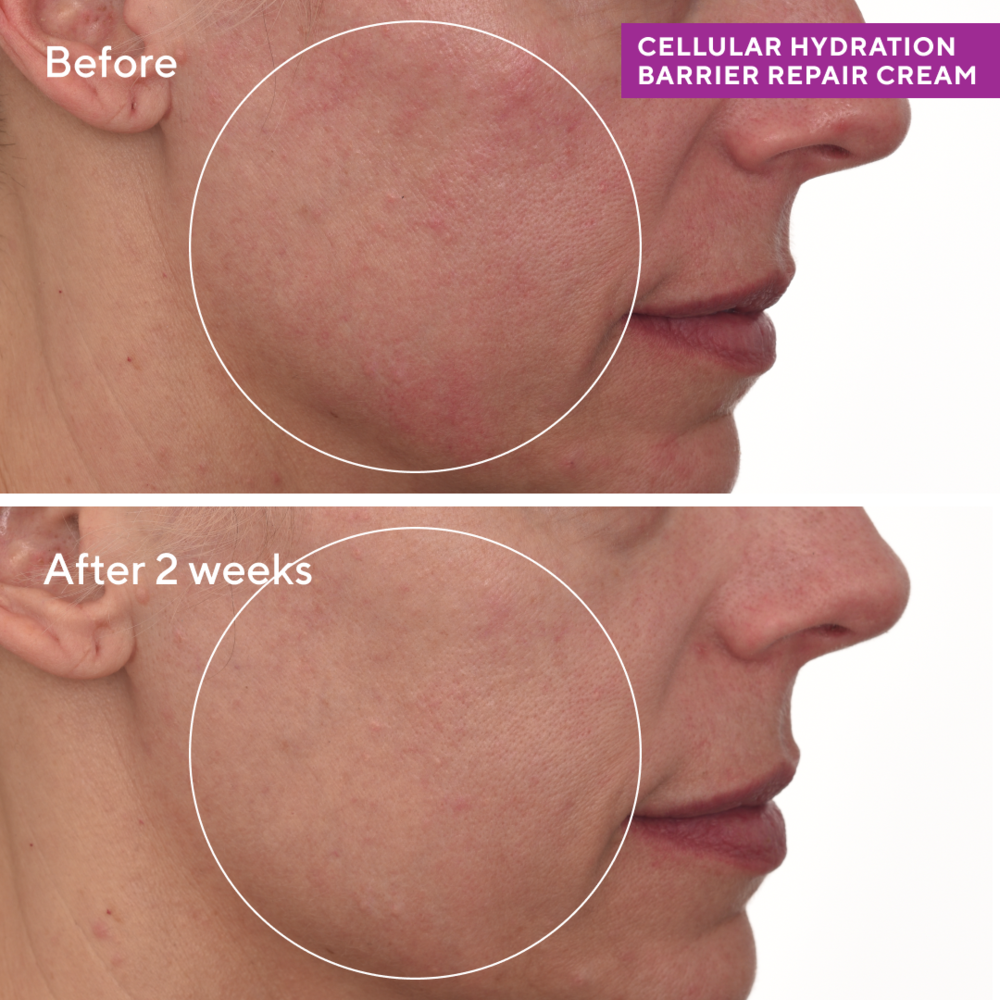 Murad HYDRATION - CELLULAR HYDRATION REPAIR CREAM