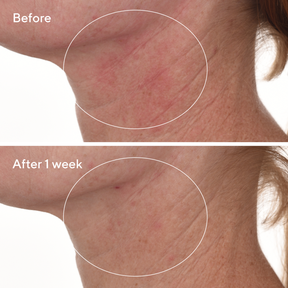 Murad HYDRATION - CELLULAR HYDRATION REPAIR SERUM