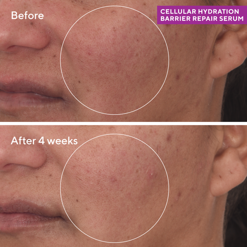 Murad HYDRATION - CELLULAR HYDRATION REPAIR SERUM