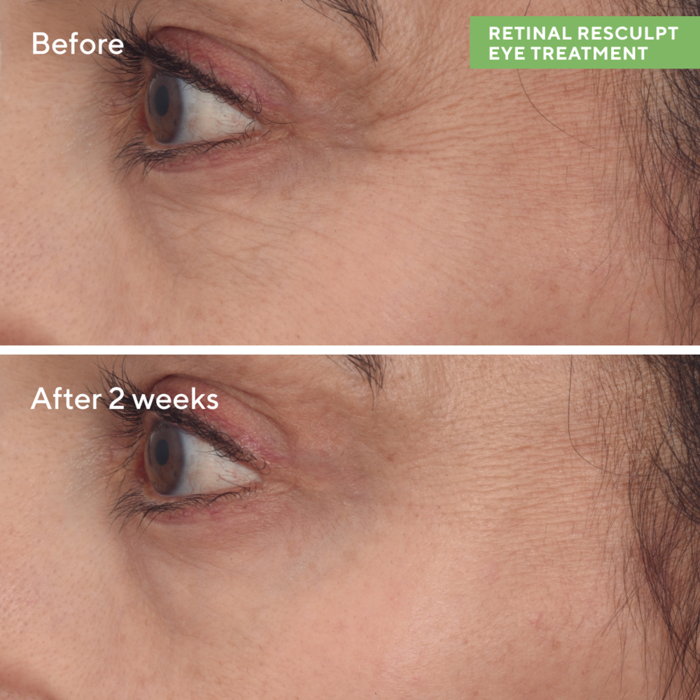 Murad RESURGENCE - RETINAL RESCULPT EYE TREATMENT
