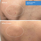 Murad BLEMISH CONTROL - RETEXTURIZING BODY PADS