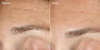 Murad RESURGENCE - REPLENISHING MULTI-ACID PEEL