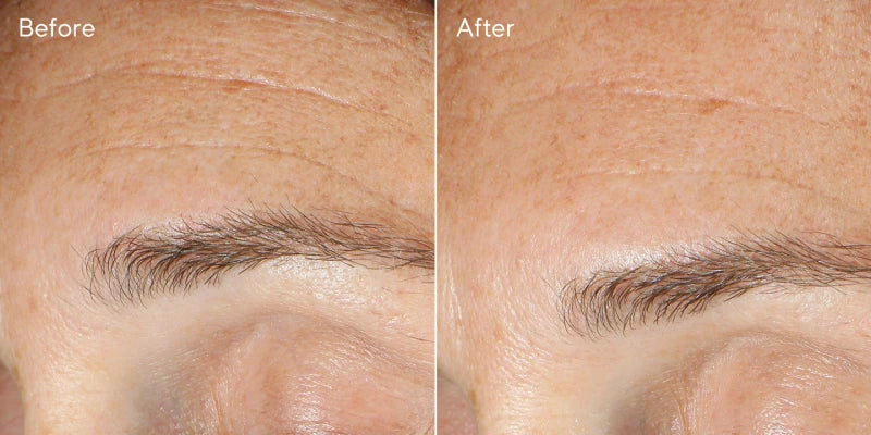 Murad RESURGENCE - REPLENISHING MULTI-ACID PEEL