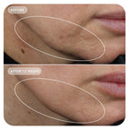 Image Skincare - VOL.U.LIFT