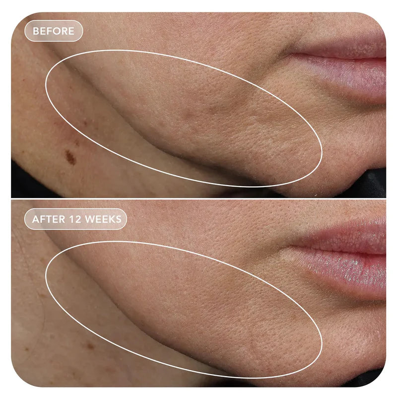 Image Skincare - VOL.U.LIFT