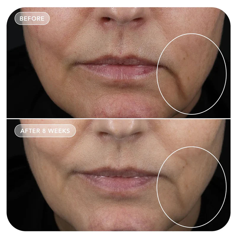 Image Skincare - VOL.U.LIFT