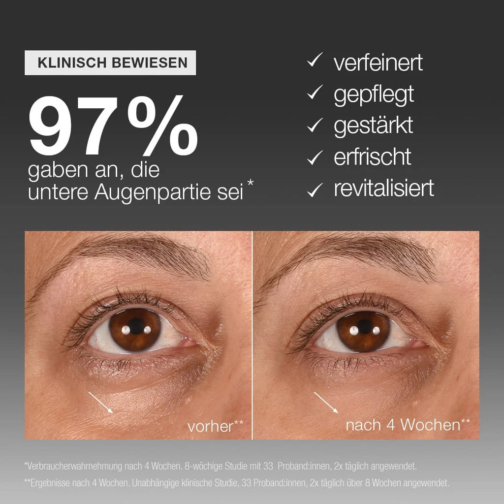 Vorher-Nachher-Fotos der Augenpartie nach vierwöchiger Anwendung des Smart Eye Density Serum von Dermalogica; 97 % der Teilnehmerinnen berichteten von einem verfeinerten, gepflegten, gestärkten, erfrischten und revitalisierten Erscheinungsbild.