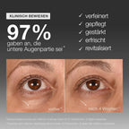 Vorher-Nachher-Fotos der Augenpartie nach vierwöchiger Anwendung des Smart Eye Density Serum von Dermalogica; 97 % der Teilnehmerinnen berichteten von einem verfeinerten, gepflegten, gestärkten, erfrischten und revitalisierten Erscheinungsbild.