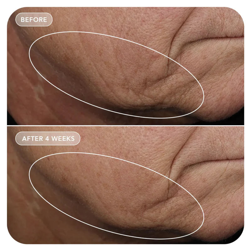 Image Skincare - VOL.U.LIFT