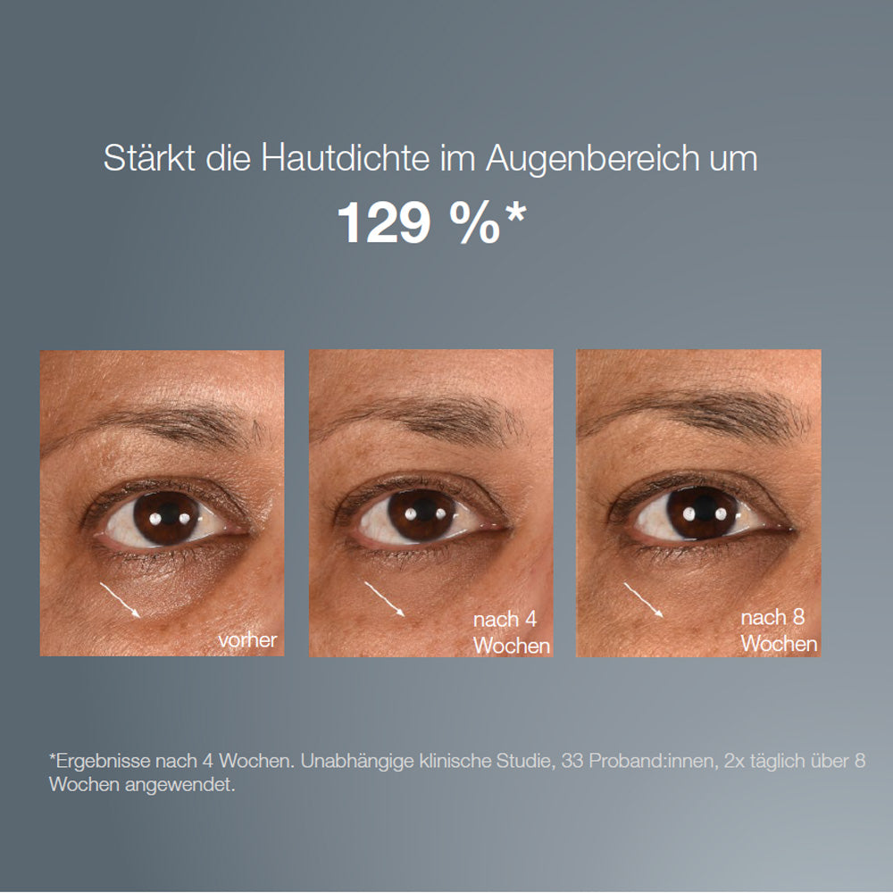Vorher-Nachher-Vergleich der Augenpartie, der eine verbesserte Hautdichte nach 4 und 8 Wochen Anwendung des dermalogica Smart Eye Density Serum zeigt, mit einem Text, der eine Steigerung der Hautdichte um 129 % verspricht.